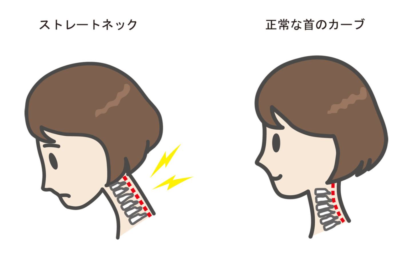 ストレートネックの原因